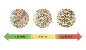 Precision Bone Scans